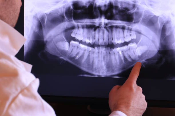 Best Emergency Dentist for Knocked-Out Tooth in Margate City, NJ