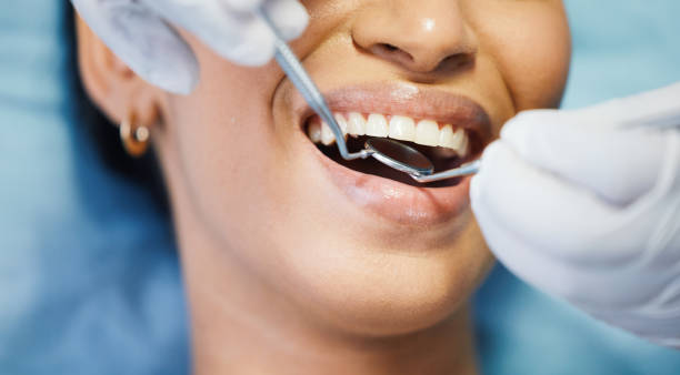 Best Emergency Dentist for Lost Fillings or Crowns in Margate City, NJ